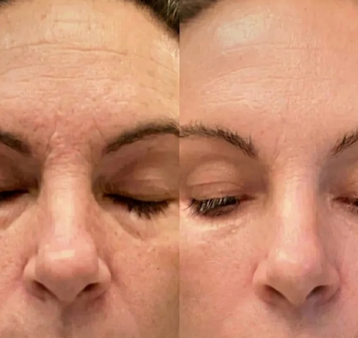 Velora PDRN Collagen Volume Balm