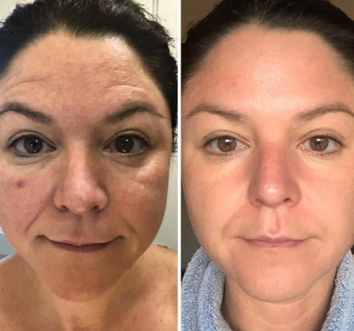 Velora PDRN Collagen Volume Balm